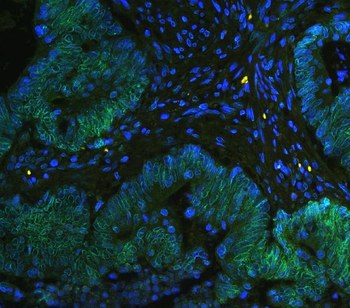 TPR Antibody