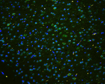 TPR Antibody