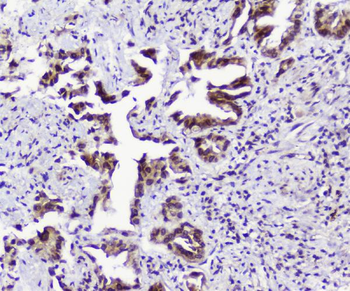 TPR Antibody