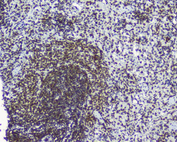 TPR Antibody