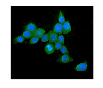 Hsp70 HSPA1A Mouse Monoclonal Antibody
