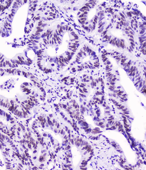 SMC3 Mouse Monoclonal Antibody