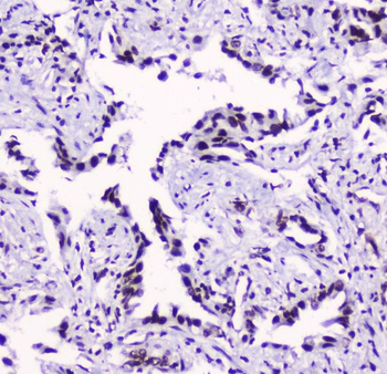 SMC3 Mouse Monoclonal Antibody