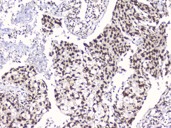 RbAp48 RBBP4 Antibody (monoclonal, 9F3)