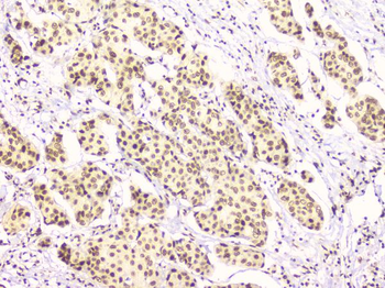 RbAp48 RBBP4 Antibody (monoclonal, 9F3)