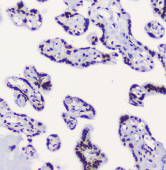 RbAp48 RBBP4 Antibody (monoclonal, 9F3)