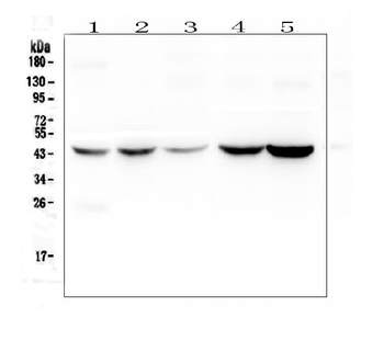 Alpha 1 microglobulin/AMBP Rabbit Polyclonal Antibody