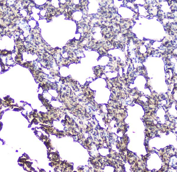Aquaporin 5/AQP5 Rabbit Polyclonal Antibody