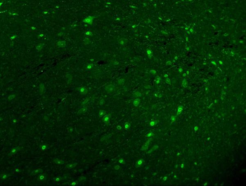 Calbindin/CALB1 Antibody