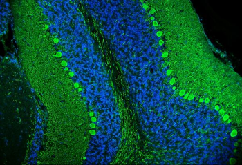 Calbindin/CALB1 Antibody