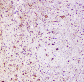 Calbindin/CALB1 Antibody