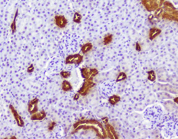 Calbindin/CALB1 Antibody