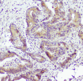 Caspase-2/CASP2 Rabbit Polyclonal Antibody