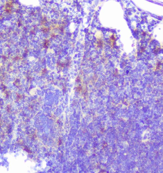Caspase-2/CASP2 Rabbit Polyclonal Antibody