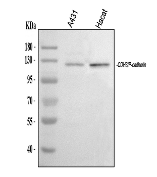 P-Cadherin-3 CDH3-/CDH3 Rabbit Polyclonal Antibody