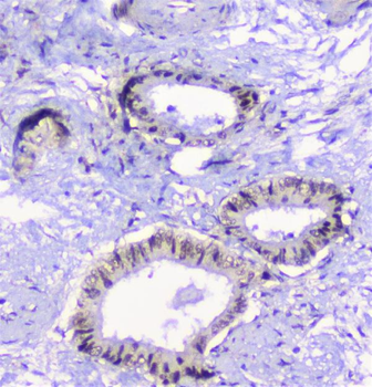 CFP Antibody