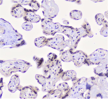 CFP Antibody