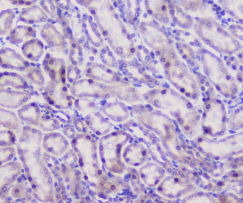 CFP Antibody
