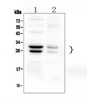 COMT Rabbit Polyclonal Antibody