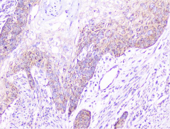 Cortactin/CTTN Antibody