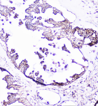 Cortactin/CTTN Antibody