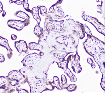 Cortactin/CTTN Antibody