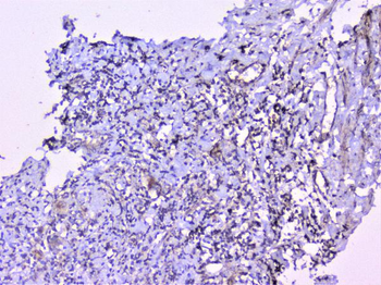 Cortactin/CTTN Antibody