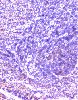 Cortactin/CTTN Antibody