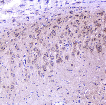 Cortactin/CTTN Antibody