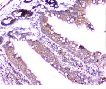 Cortactin/CTTN Antibody