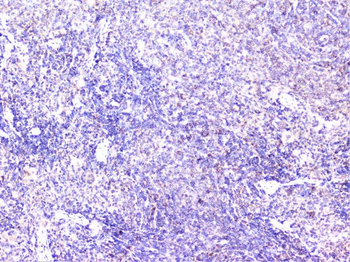 Cortactin/CTTN Antibody