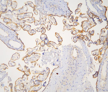 Cortactin/CTTN Antibody