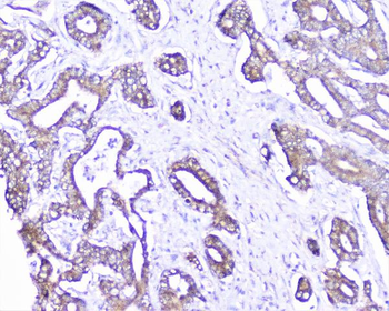 Cortactin/CTTN Antibody