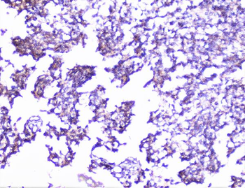 Cortactin/CTTN Antibody