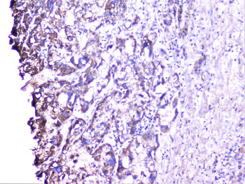 Cortactin/CTTN Antibody