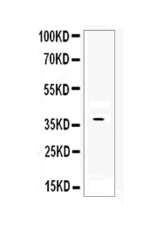 DKK1 Rabbit Polyclonal Antibody