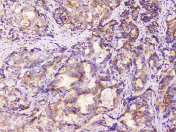 EML4 Antibody