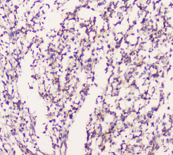 EML4 Antibody