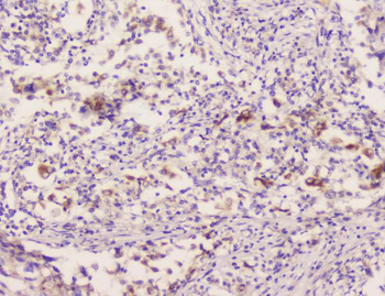 EML4 Antibody