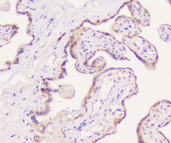 EML4 Antibody