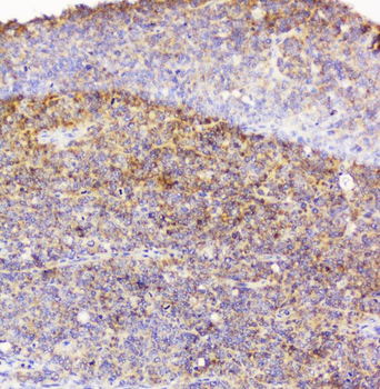 EML4 Antibody