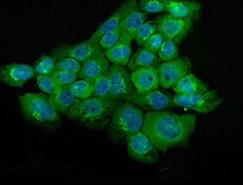 NSE/ENO2 Antibody