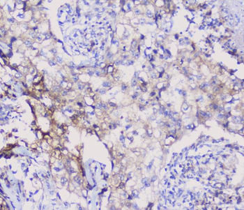 NSE/ENO2 Antibody