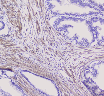 NSE/ENO2 Antibody