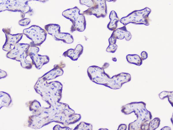 NSE/ENO2 Antibody