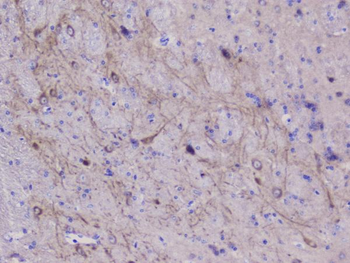 NSE/ENO2 Antibody