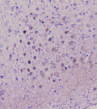 NSE/ENO2 Antibody