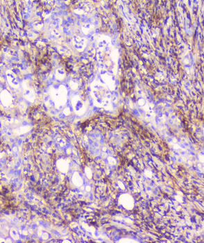 FCGR2A Antibody