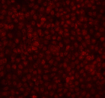 FGF2 Rabbit Polyclonal Antibody