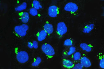 GM130/GOLGA2 Antibody
